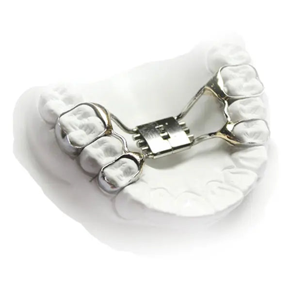 Rapid Palatal Expander