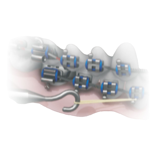 Force Gauge Dynamometer - 100 to 1600gf (cN)