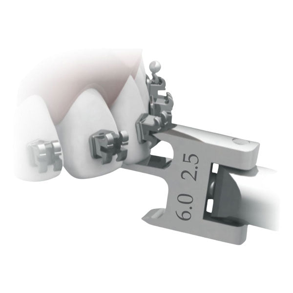 Bracket Placement Guide 2.5-3.0-5.5-6.0mm