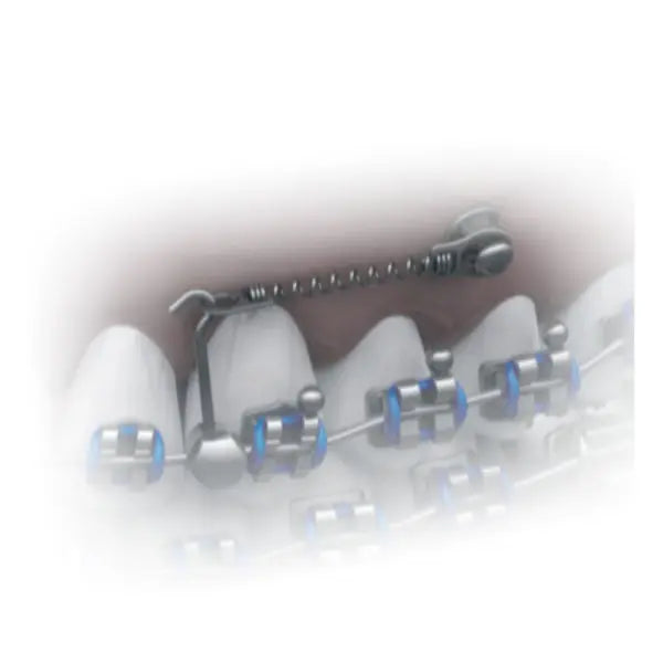 TAD Nickel-Titanium Closed Coil Spring