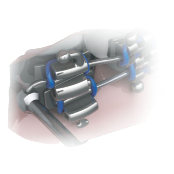 Closed Distal Bender