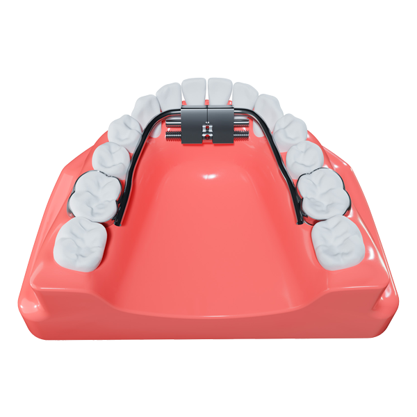 Micro Expander