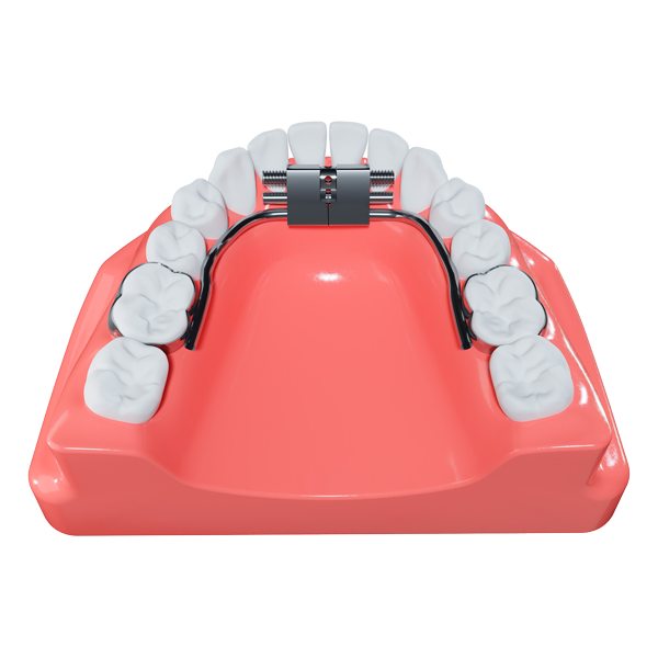 Micro Expander