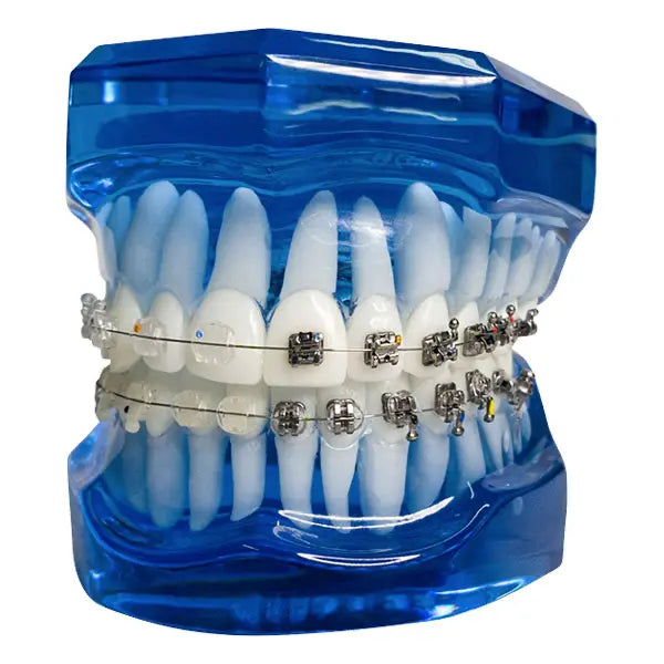 Mixed Bracket Systems Typodont