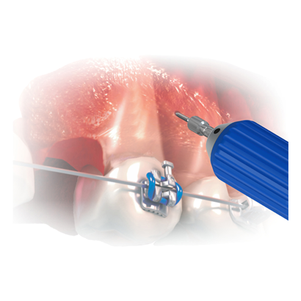 Screwdriver Handle Blue