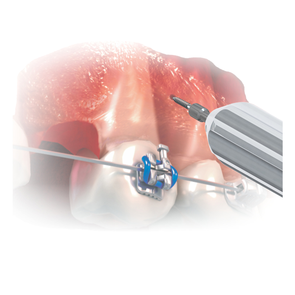 Short Contra-Angle Pick-Up Driver